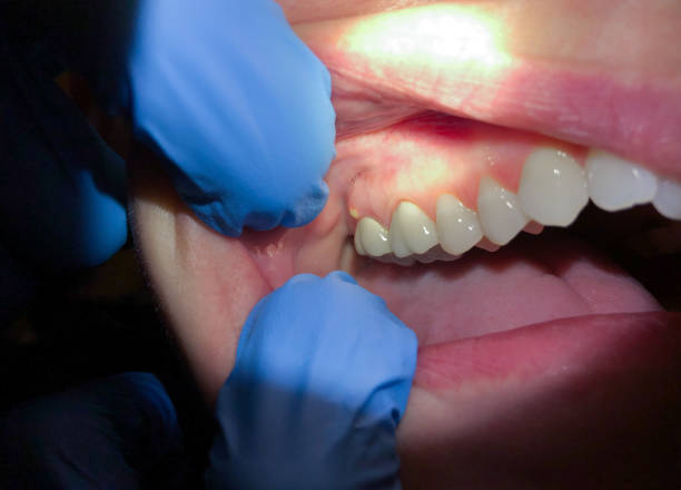 Best Mobile Emergency Dentist in West Columbia, SC