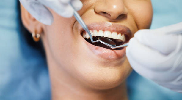 Best Emergency Dentist for Knocked-Out Tooth in West Columbia, SC