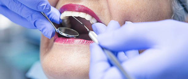 Best Emergency Cosmetic Dentistry in West Columbia, SC